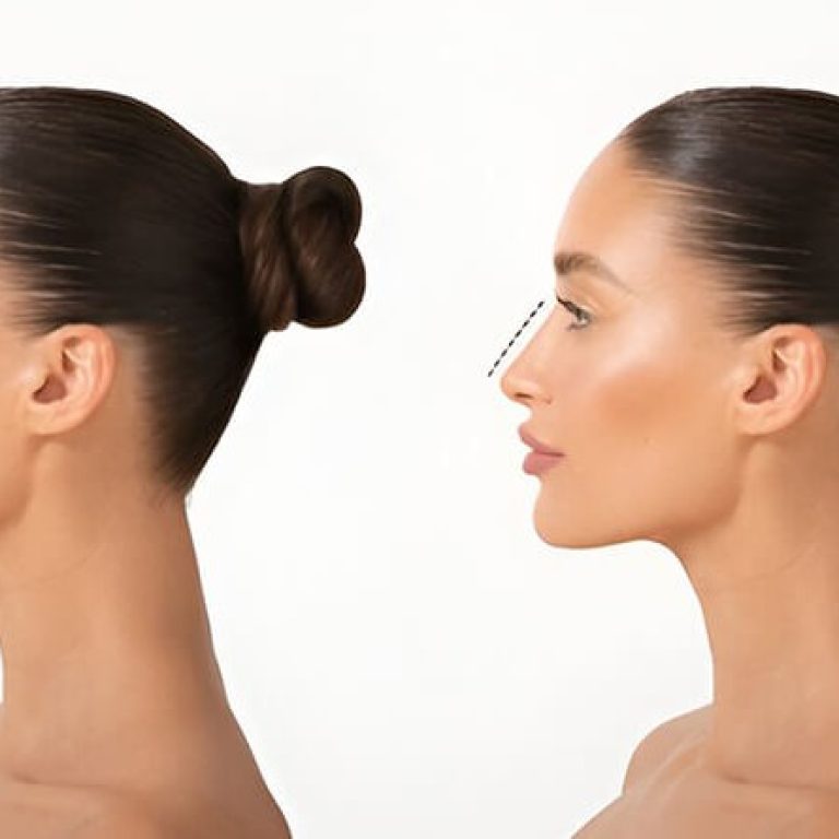 Rhinoplasty Surgery at Magniva Aesthetics in Mumbai